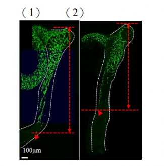 In the figures, neurons are green in color.  1) At the early stage of the development, majority of the gut is colonised by neurons; 2) an obvious delay of gut colonisation was observed in mice with abnormal GLI protein, that mimics the situation of patient with Hirschsprung disease. Red line indicates the distance of gut colonisation.